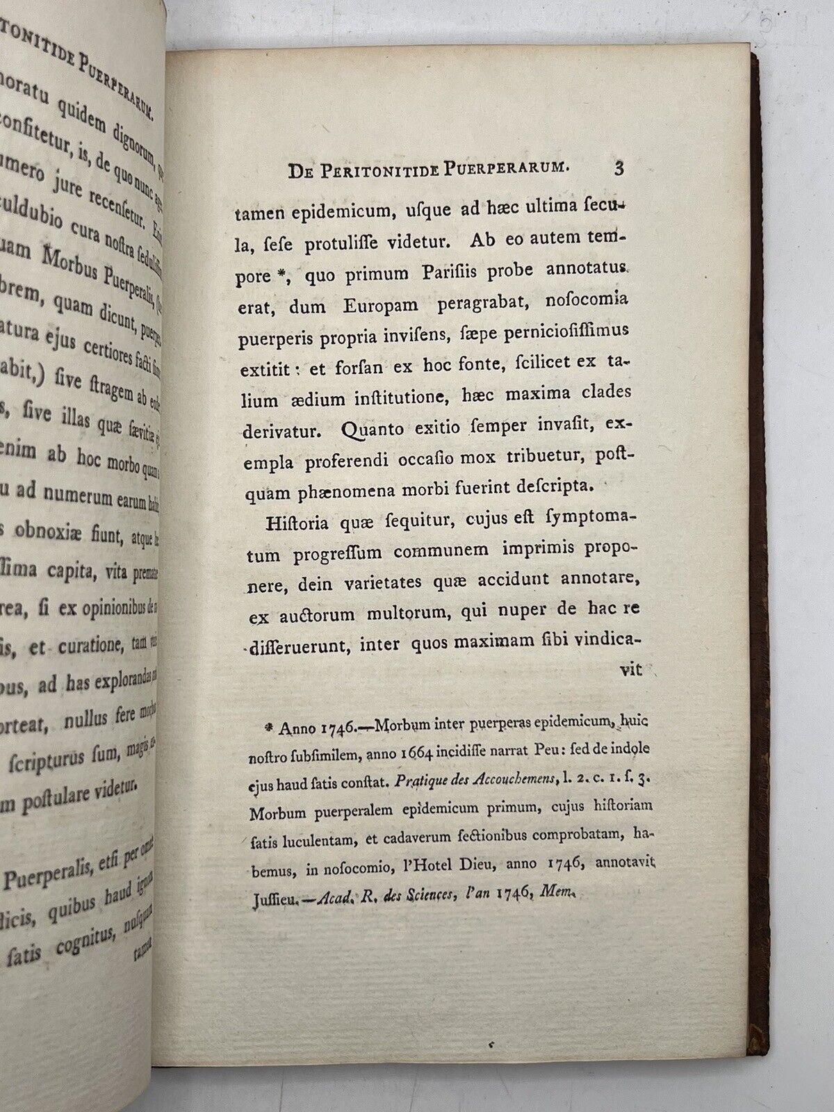 On Peritonitis in Postpartum Women by D. George Baird 1796